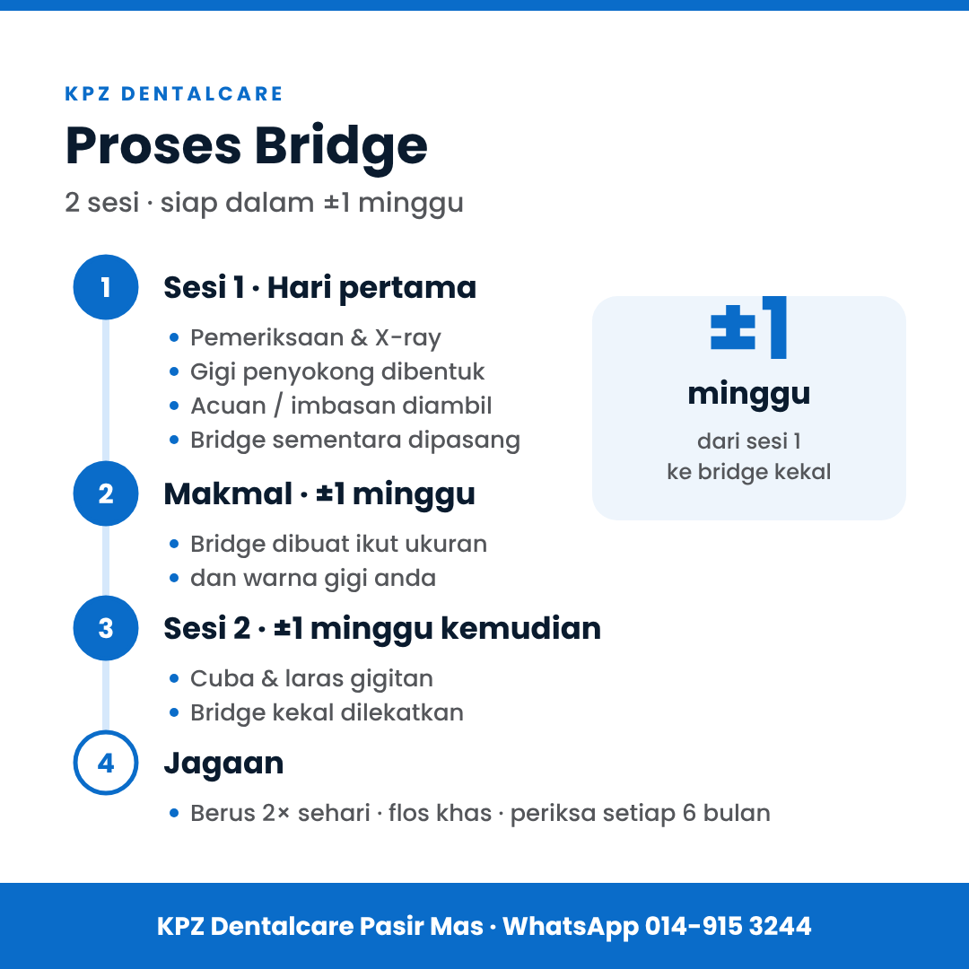 Proses bridge: sesi 1 pemeriksaan, gigi penyokong dibentuk, acuan diambil dan bridge sementara; makmal lebih kurang 1 minggu; sesi 2 bridge kekal dilekatkan.
